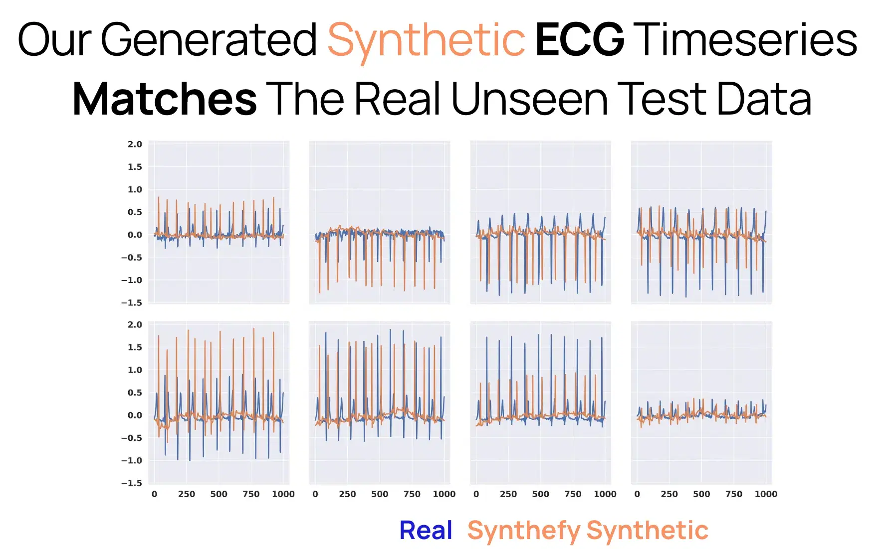 Synthefy creates high-quality synthetic ECG signals